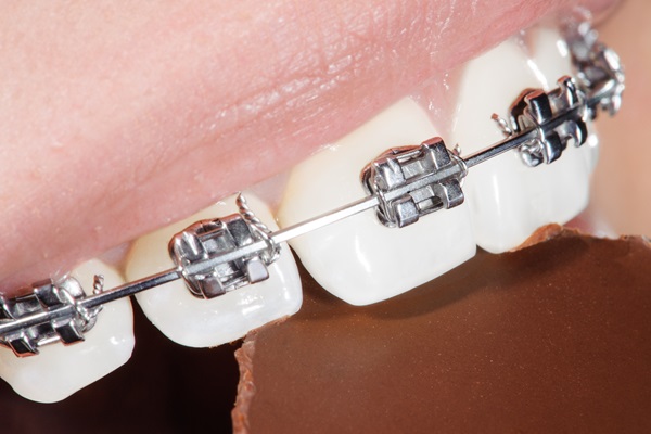 Braces Specialist: Your Path To Straighter Teeth